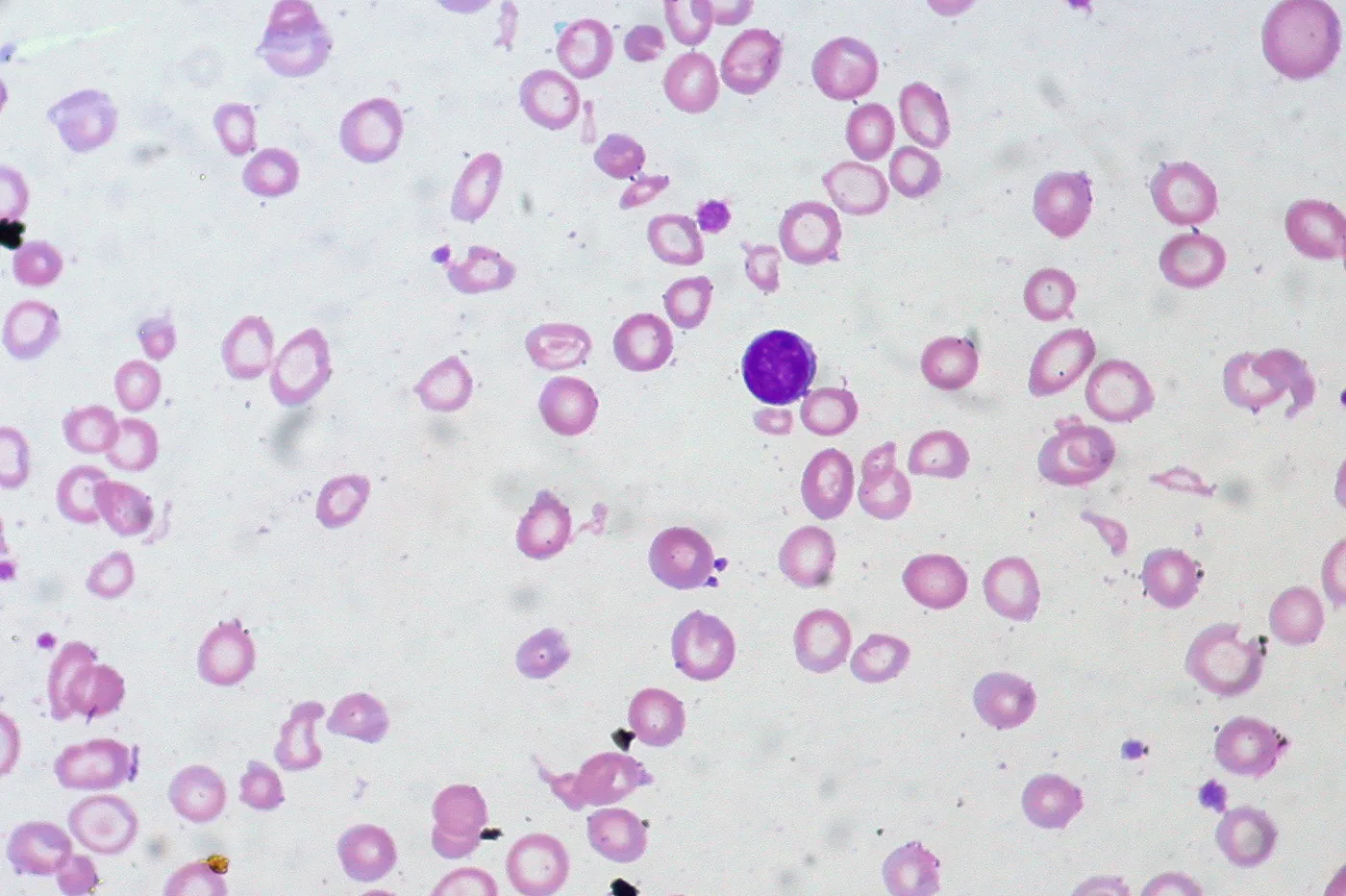 Microscopic blood cell analysis supporting a complete blood count